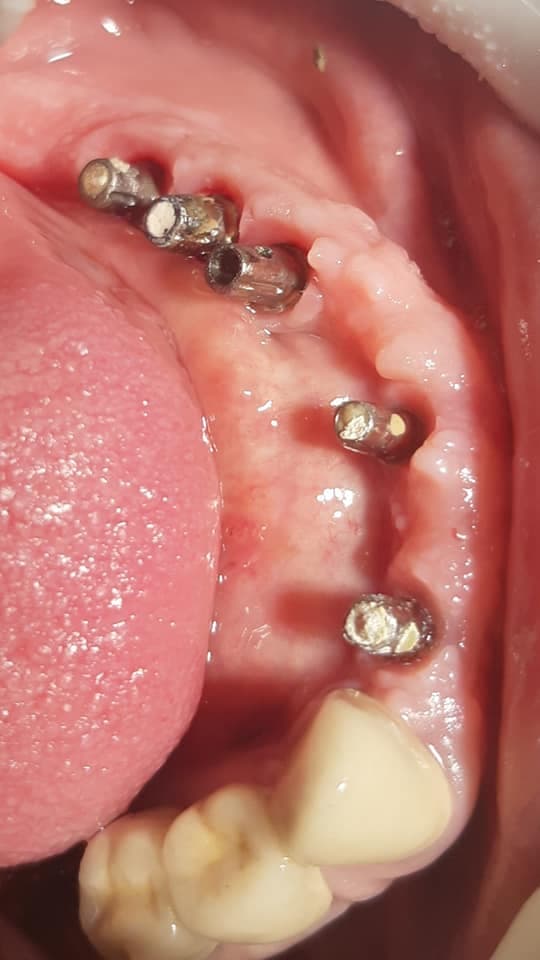 Geeta Dental Hospital and Implant Centre
