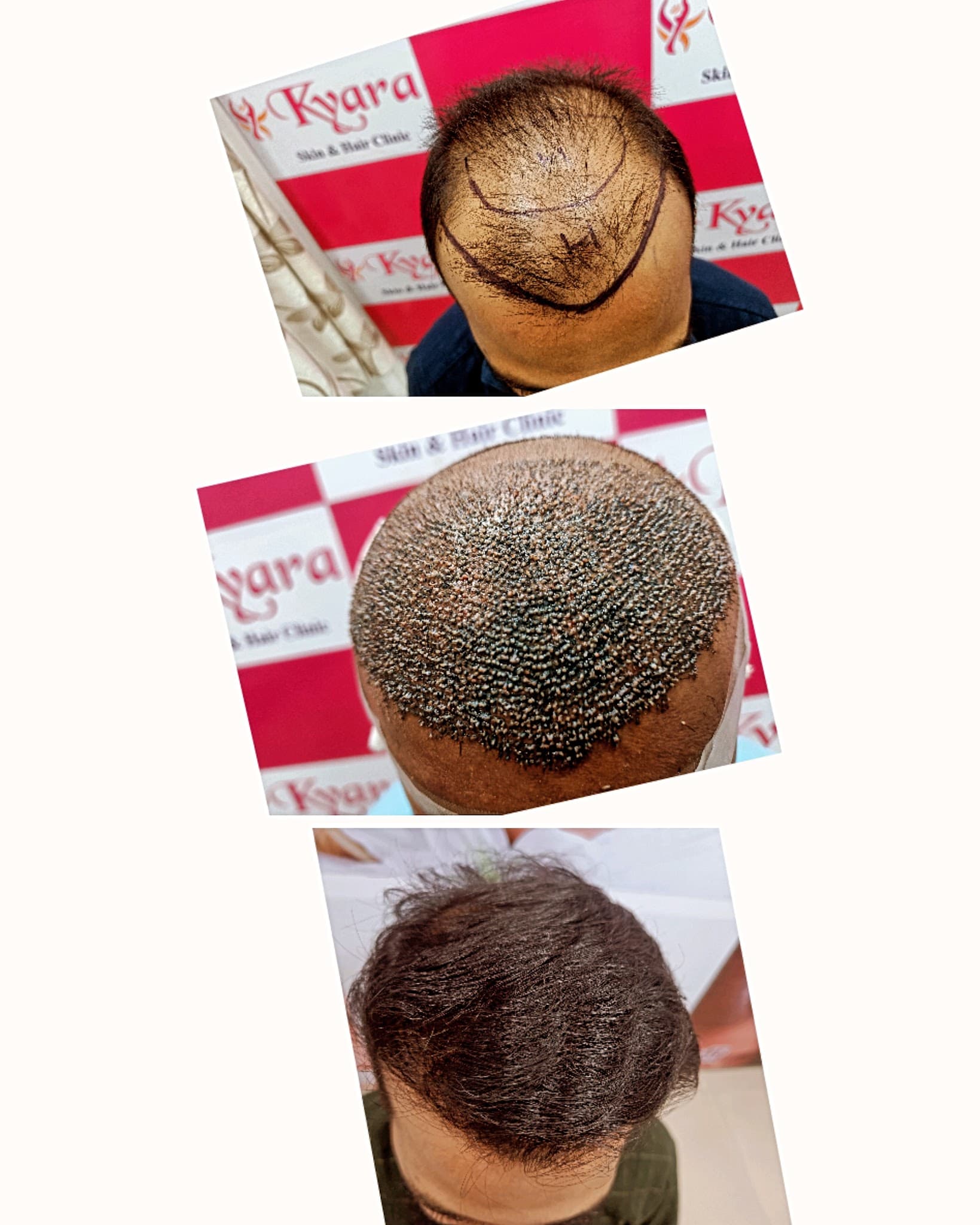 Kyara Skin & Hair Clinic Surat