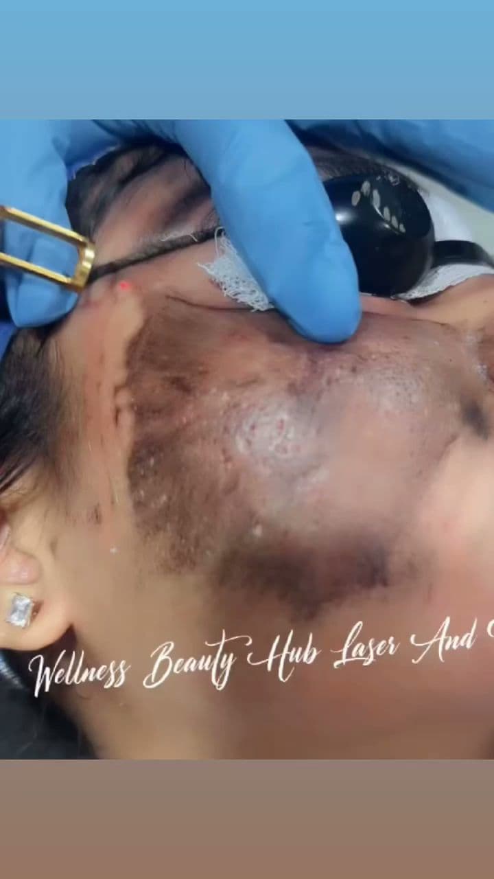 Wellness Beauty Hub (Cosmetic & Laser Center) | Permanent Makeup | Laser Hair Removal Center